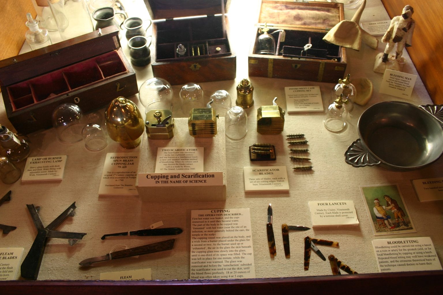 Cupping and scarification, Old Operating Theatre & Herb Garret, London - 01.JPG